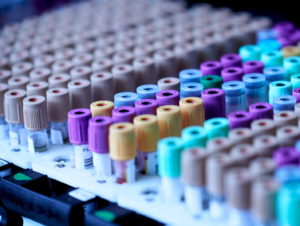 Marta Busquets Foto Estrias 2